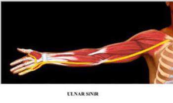 Urnal Sinir Sıkışması