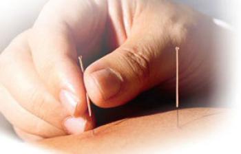 İMS ile Akupunktur arasındaki farklar nelerdir ?
