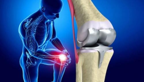 Menisküs Yırtıkları